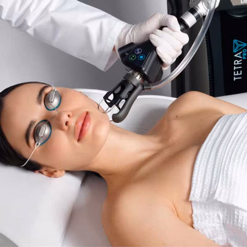 CO2 Laser Resurfacing